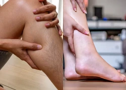 Người đàn ông 45 tuổi có dấu hiệu suy thận từ lâu nhưng không biết