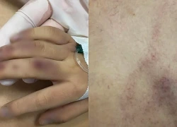 Tạm giữ giáo viên mầm non nghi đánh con riêng của chồng tử vong