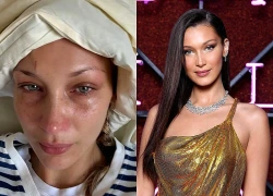 Bella Hadid đau đớn, tàn tạ không nhận ra khi bệnh nặng tái phát
