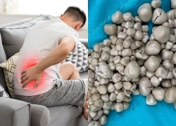 Những dấu hiệu cảnh báo sỏi thận giai đoạn đầu