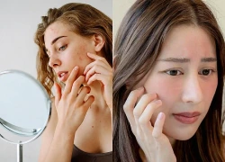 3 sai lầm khi dưỡng da mùa hè khiến da nổi mụn, lão hóa nhanh gấp nhiều lần