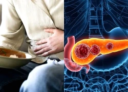 4 dấu hiệu âm thầm cảnh báo sớm ung thư tuyến tụy