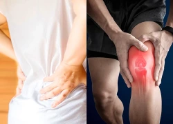 6 hiểu lầm tai hại về loãng xương