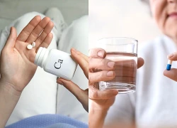 Cách bổ sung canxi mà không lo bị sỏi thận