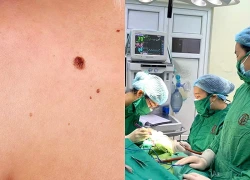 Cảnh báo ung thư da núp bóng những tổn thương tưởng chừng vô hại