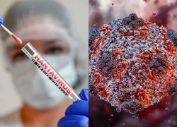 Chuyên gia lên tiếng về 'hiểm họa toàn cầu mang tên virus Hanta'