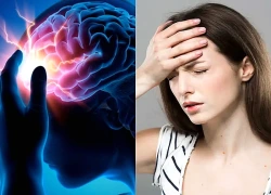 Đau đầu, buồn nôn kéo dài, người phụ nữ 44 tuổi bất ngờ phát hiện phình động mạch não