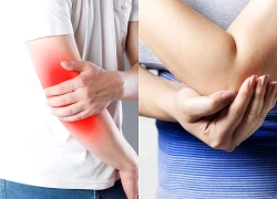 Đau nhức khuỷu tay cảnh báo những bệnh lý nào?