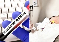 FDA ưu tiên xem xét đơn đăng ký thuốc giredestrant của Roche trong điều trị ung thư vú