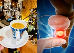 Mối liên hệ giữa uống cà phê và nguy cơ ung thư tuyến tiền liệt