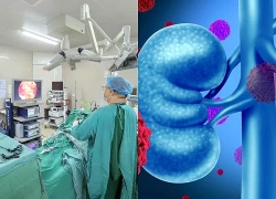 Người đàn ông đang khỏe mạnh bất ngờ phát hiện ung thư thận: Bác sĩ cảnh báo dấu hiệu dễ bị bỏ qua