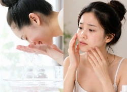 Sai lầm chăm sóc da dầu mùa hè nhiều người mắc phải khiến da xỉn màu, dễ nổi mụn