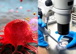 Thuốc miễn dịch thế hệ mới giúp kéo dài sự sống gần 28 tháng cho bệnh nhân ung thư phổi