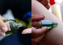 6 sai lầm khiến dầu gió càng bôi càng vô tác dụng