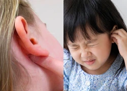 Dấu hiệu nhọt ống tai ngoài ở trẻ và cách xử trí đúng