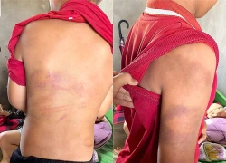 Đến thăm cháu trai, bà ngoại phát hiện chuyện đau lòng, vội trình báo công an