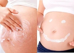 3 nguyên tắc giúp hạn chế rạn da khi mang thai