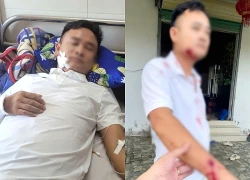 Khởi tố nhóm người nổ súng khi đi đòi nợ