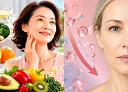 Sau mãn kinh: Vì sao da lão hóa nhanh trong những năm đầu?
