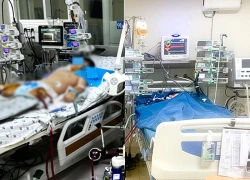 Bé trai bỗng sốc tim nguy kịch sau khi sốt nhẹ vì một siêu vi thông thường