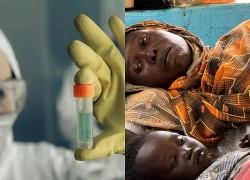 Dịch tả tại Nigeria khiến ít nhất 90 người tử vong