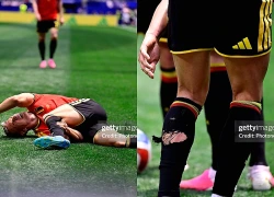 Bị rách tất, chảy máu chân nhưng đồng đội ngăn y tế vào sân: Sao tuyển Bỉ trở thành nạn nhân của luật mới của World Cup 2026