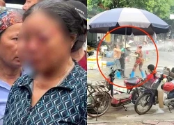 Con trai người bán rau bị xịt nước vào mặt: "Mẹ tôi vẫn đau, hoảng loạn"