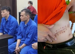 Mua thận gần 1 tỷ, người bán nhận 500 triệu đồng
