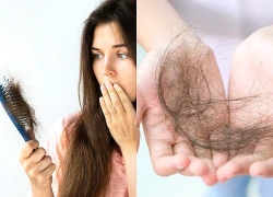 3 bí quyết hạn chế rụng tóc ở tuổi mãn kinh