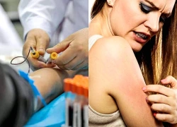 Bác sĩ nhắc nhở: Nếu cánh tay xuất hiện 4 dấu hiệu này, đừng chần chừ đi khám