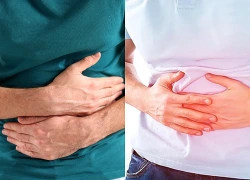 Đau bụng kéo dài không rõ nguyên nhân: Cảnh giác với viêm túi thừa Meckel