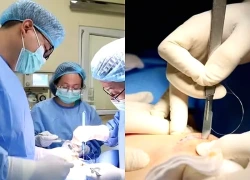 Định vị tổn thương sớm giúp truy tìm, xử lý chính xác tổn thương vú