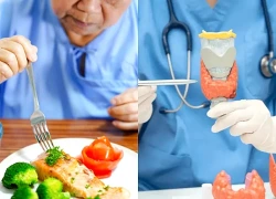 Thực đơn 7 ngày cho người bệnh sau mổ u tuyến giáp