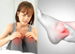 Trẻ thường xuyên đau nhức khớp vào buổi sáng, cảnh báo sớm viêm khớp tự phát