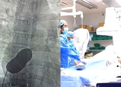 Bất ngờ phát hiện mắc tim bẩm sinh trước khi lên bàn mổ
