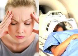 Chủ quan với đau đầu kéo dài, người đàn ông phát hiện u màng não chèn ép dây thần kinh