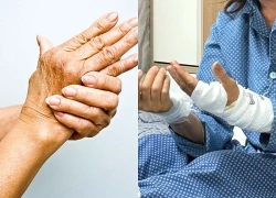 Tê bì tay, không bế nổi cháu người phụ nữ suýt mất chức năng bàn tay