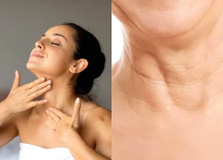 5 bài massage vùng cổ giúp cải thiện nếp nhăn và hạn chế chảy xệ