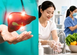 5 thói quen giúp giảm nguy cơ viêm gan, bảo vệ lá gan khỏe mạnh