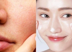 Da mịn hơn, lỗ chân lông bớt lộ rõ nhờ 4 bước chăm sóc nhiều người đang bỏ qua