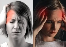 Người phụ nữ 59 tuổi đau đầu nhiều năm, đi khám phát hiện u não