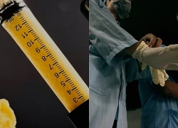 'Tiêm mỡ tử thi' Trào lưu làm đẹp gây tranh cãi tại Mỹ