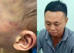 Vụ tát, bóp cổ con riêng của vợ ở Gia Lai: Tạm giữ cha dượng