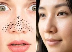 5 bước chăm sóc da giúp cải thiện tình trạng lỗ chân lông to