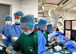 Đau đầu kéo dài, người phụ nữ phát hiện "quả bom" nổ chậm trong não