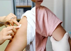 Quên tiêm mũi nhắc vaccine, trẻ vẫn có nguy cơ mắc viêm não Nhật Bản