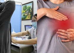 4 dấu hiệu bất thường cảnh báo ung thư vú