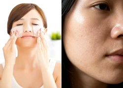 6 sai lầm khi chăm sóc da dầu khiến da càng đổ dầu