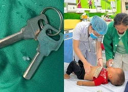 Bắc Ninh: Kịp thời nội soi gắp chùm chìa khóa trong dạ dày bé trai 30 tháng tuổi