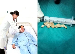Can thiệp nhanh, cứu người bệnh tím tái do hít sặc khoai mì